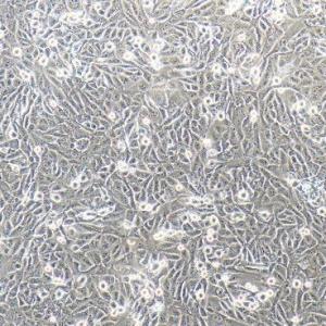 人骨肉瘤细胞; 143B
